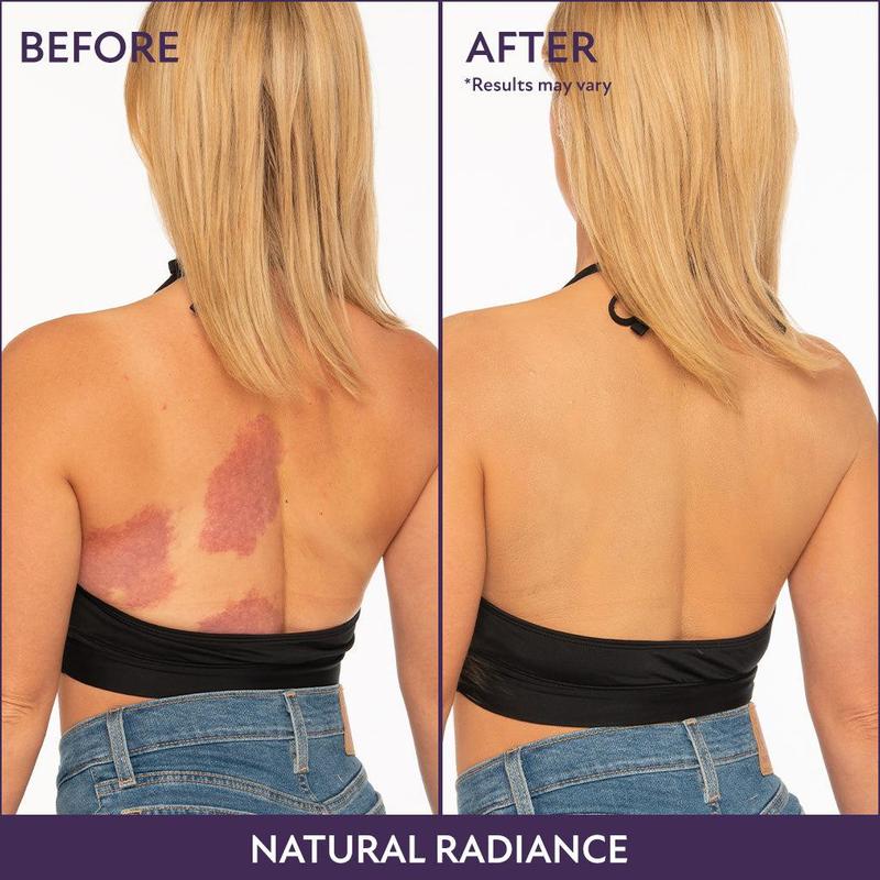 🔥LAST DAY SALE 49% OFF!!✨Body Coverage Perfector – Waterproof, lightweight & flawless body makeup