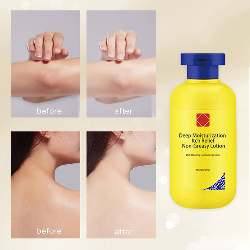 🔥This week's special price: ￡7.99!!🎁Deep Moisturization Itch Relief Non-Greasy Lotion