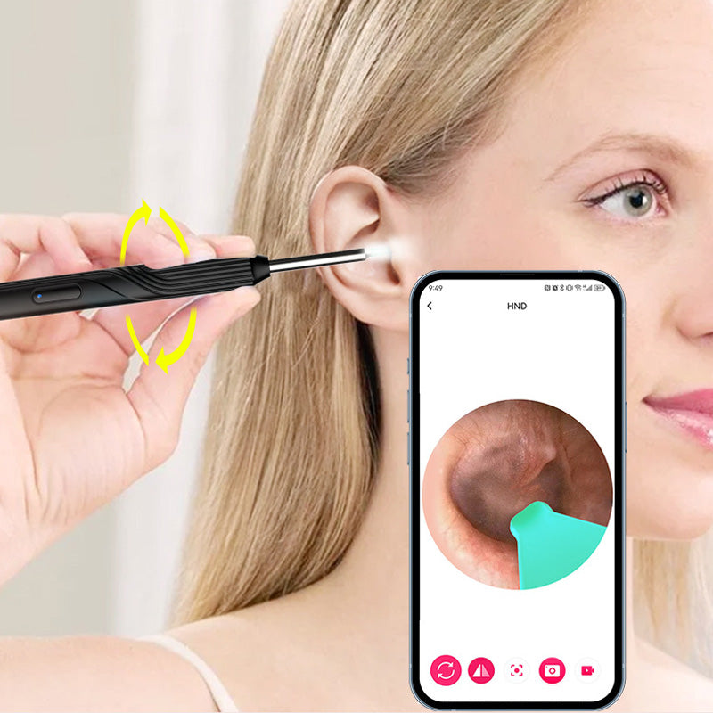 🎉2025 HOT SALE ~50% OFF🎉Earwax Removal Device with HD Camera
