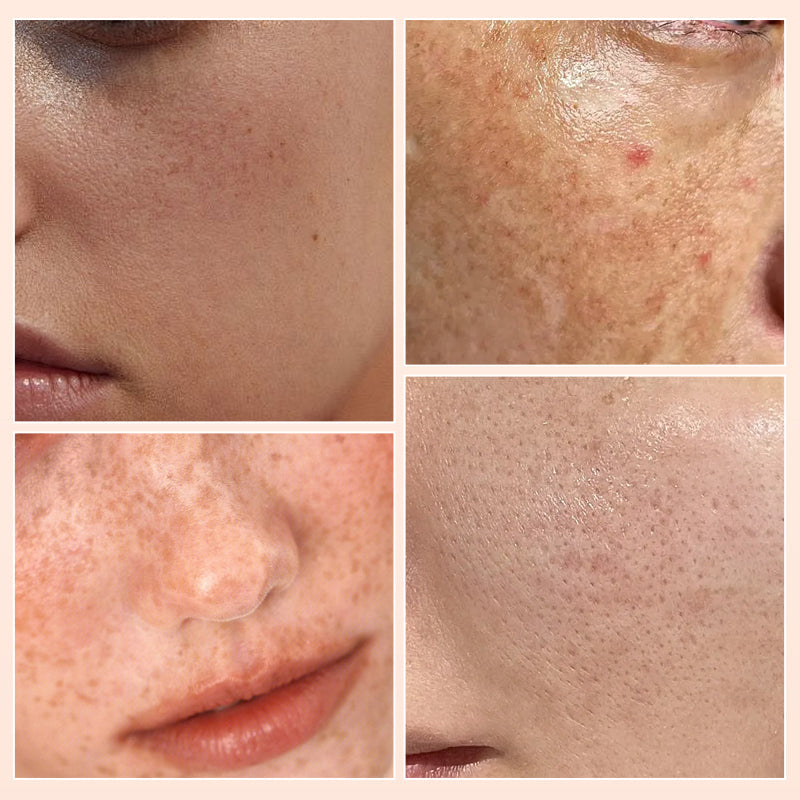 🔥Buy 2 Get 1  Free  50% OFF🔥Waterproof  Long Lasting  Fake Freckles Stamp