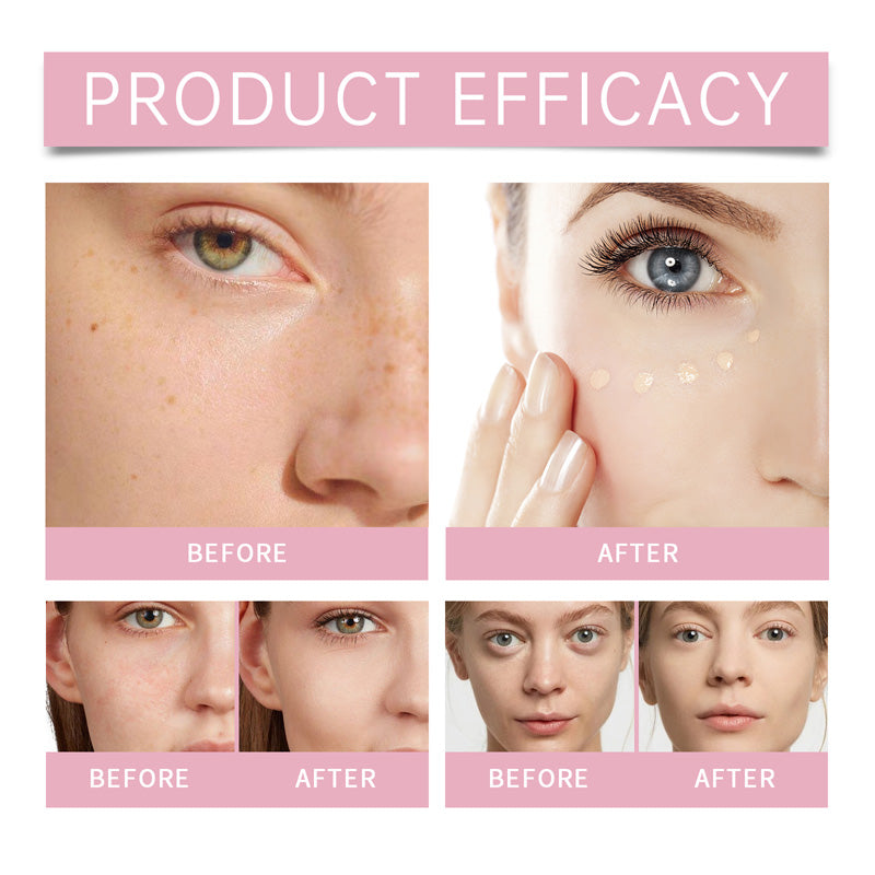🔥🎉Last Day- Buy 1 Get 1 Free✨Under Eye Brightener, Brightening Cream Concealer